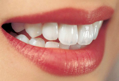 Sau khi phục hình tetracycline bằng răng sứ thì thời gian – độ bền của phục hình dùng được bao lâu?